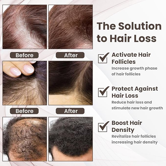 Copper Peptide Hair Growth Treatment Serum, GHK-Cu and AHK-Cu, Licorice Extract,1oz - Image 5