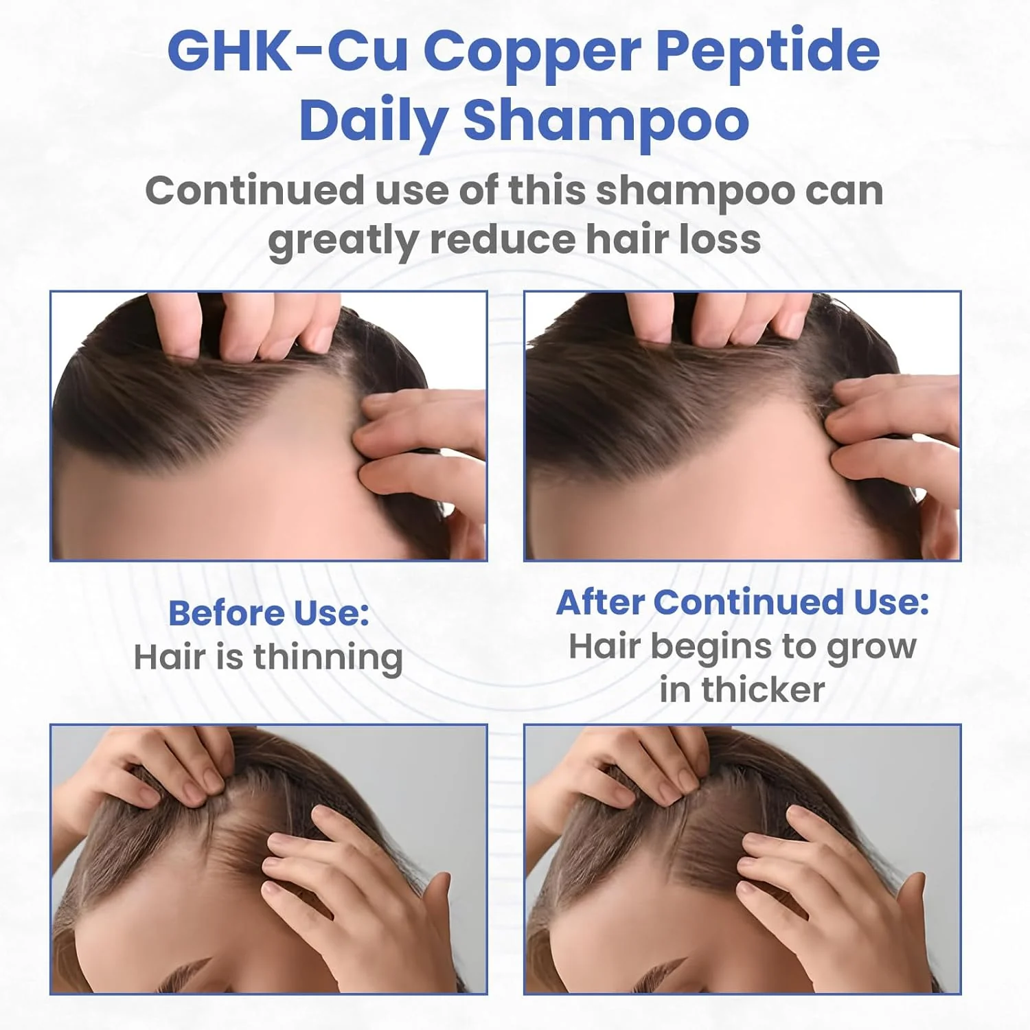 GHK-Cu Copper Peptide Shampoo - Anti Hair Loss Shampoo - Promotes New Hair Growth, 11.8 Fluid Ounce - Image 3